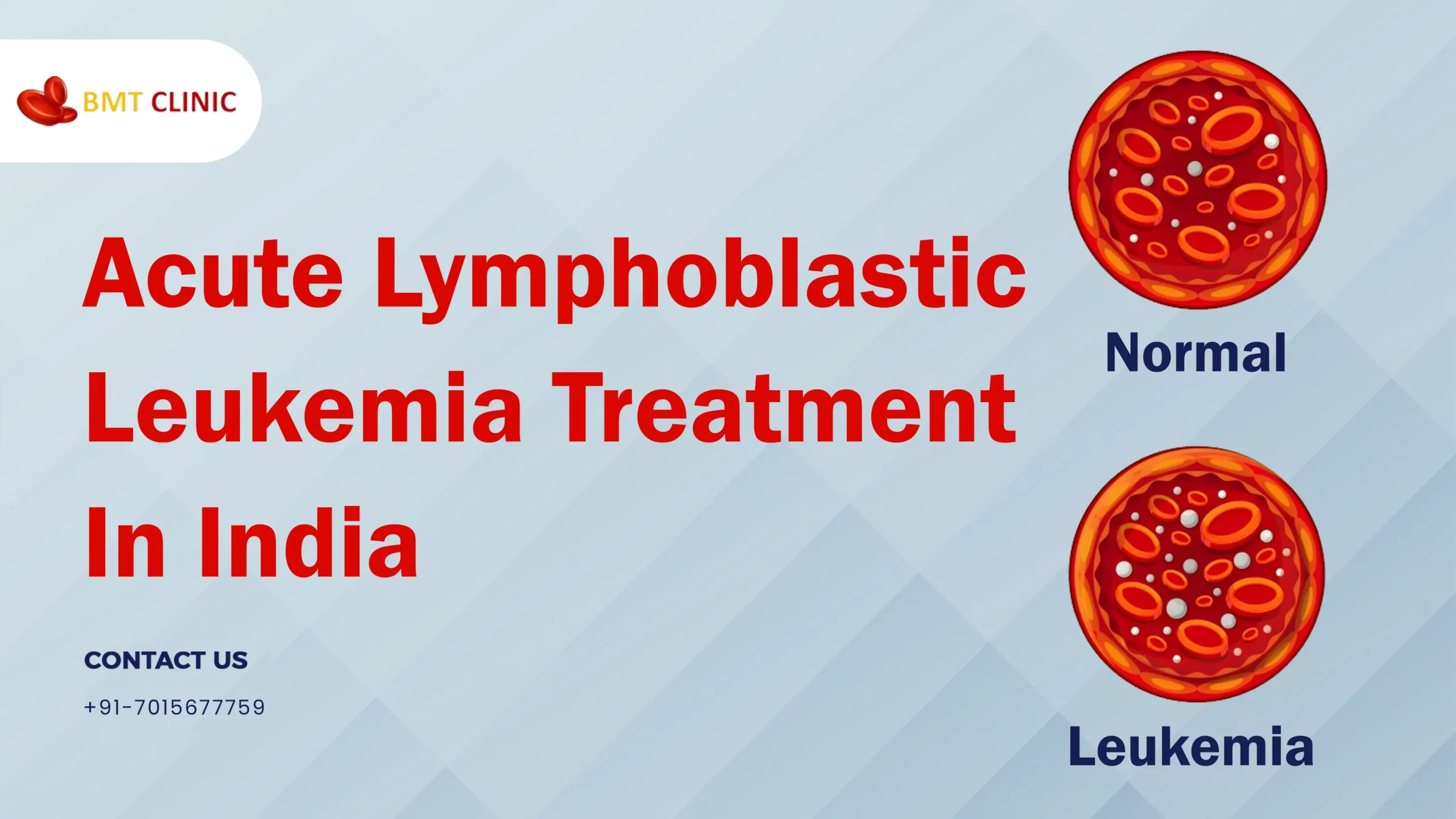 Acute Lymphoblastic Leukemia Treatment Cost in India