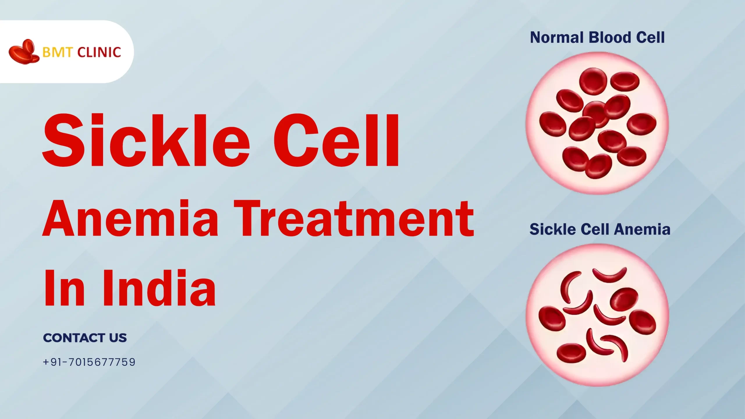 sickle-cell-anemia-treatment-cost-in-india