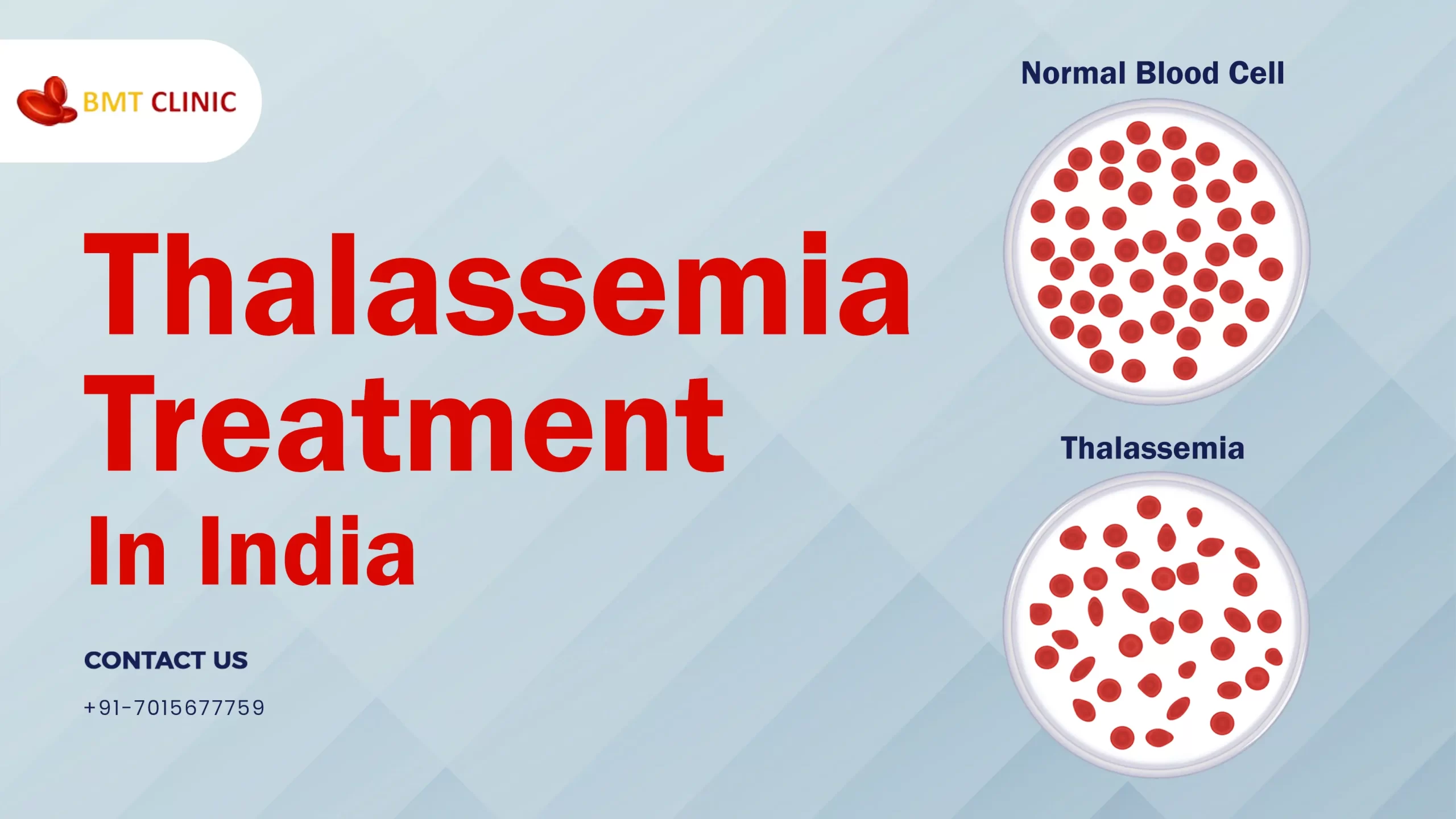 Thalassemia-treatment-cost-in-india