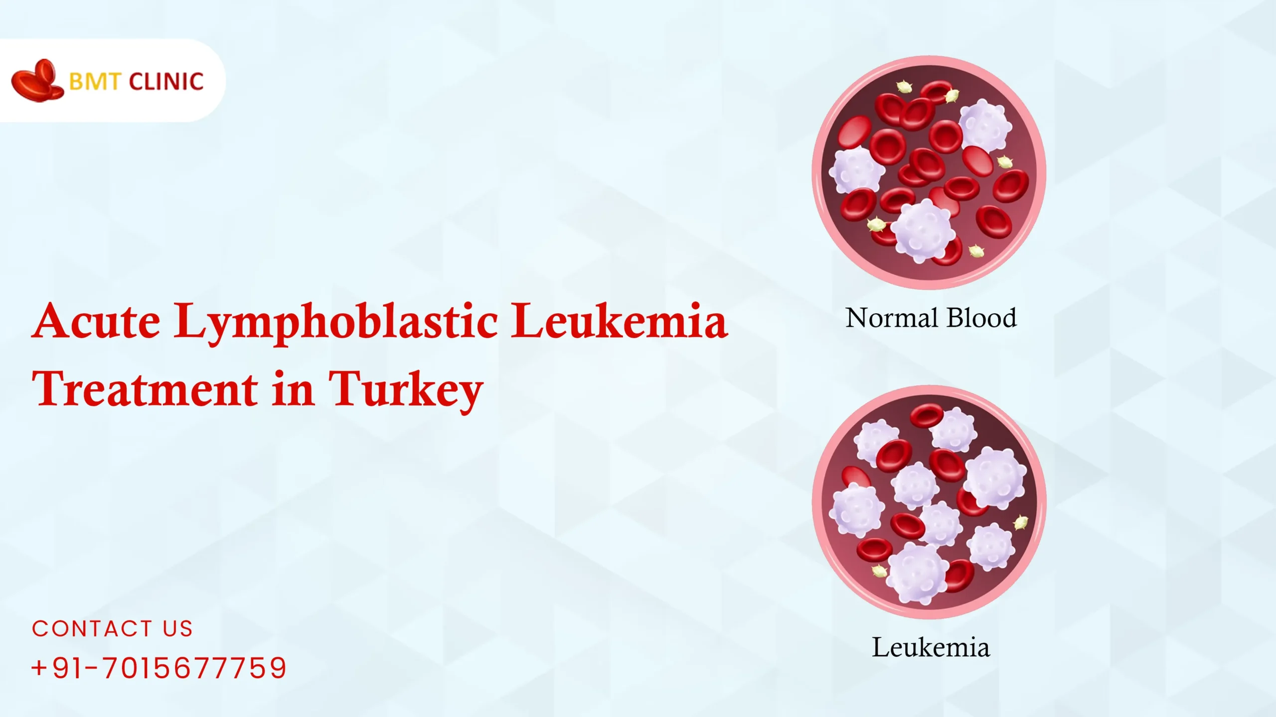 Acute Lymphoblastic Leukemia Treatment Cost in Turkey