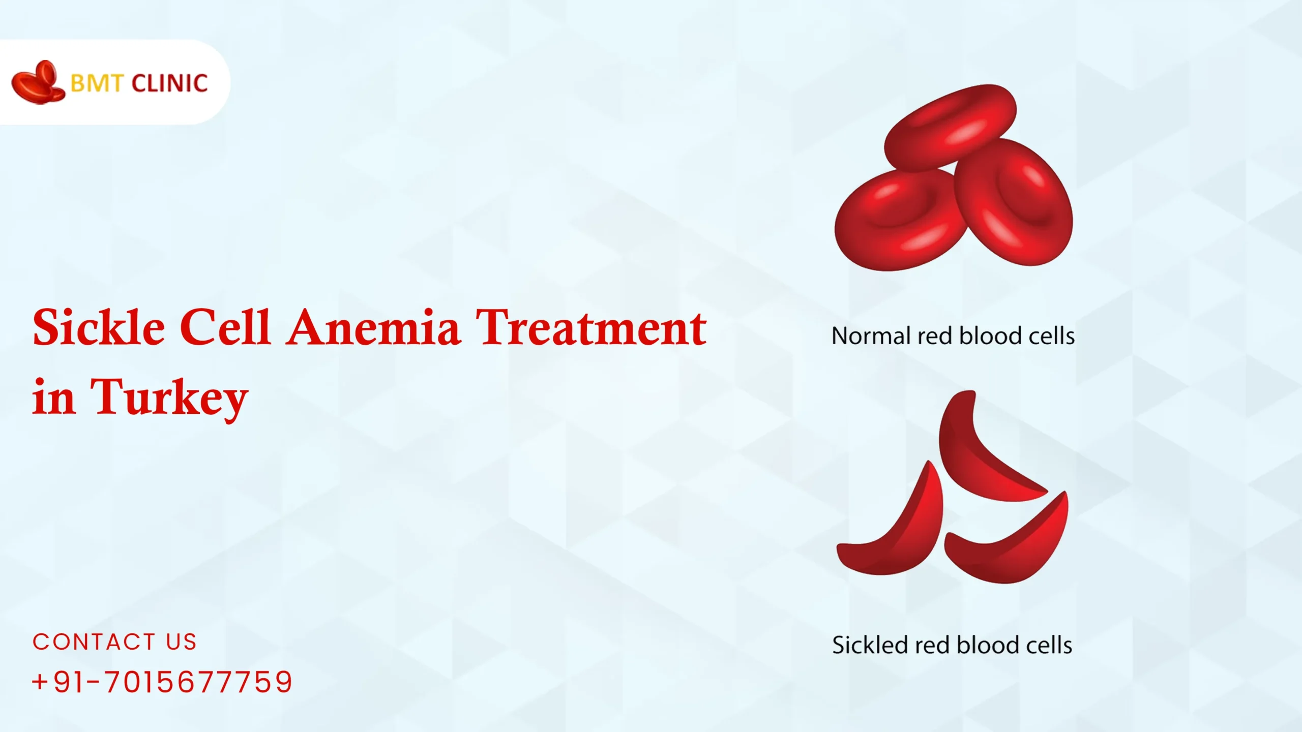 Sickle Cell Anemia Treatment Cost in India