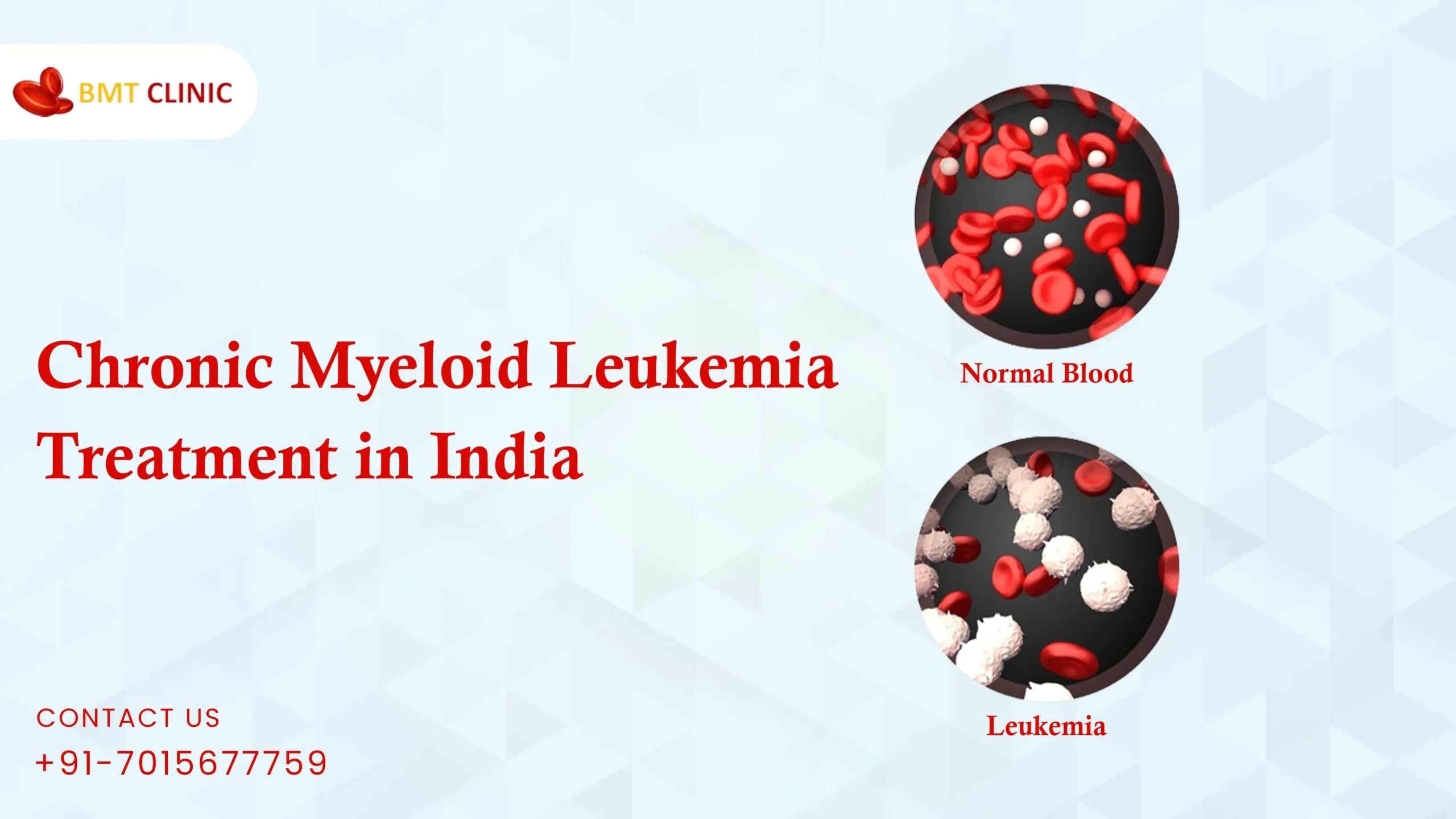 Chronic Myeloid Leukemia Treatment Cost in India