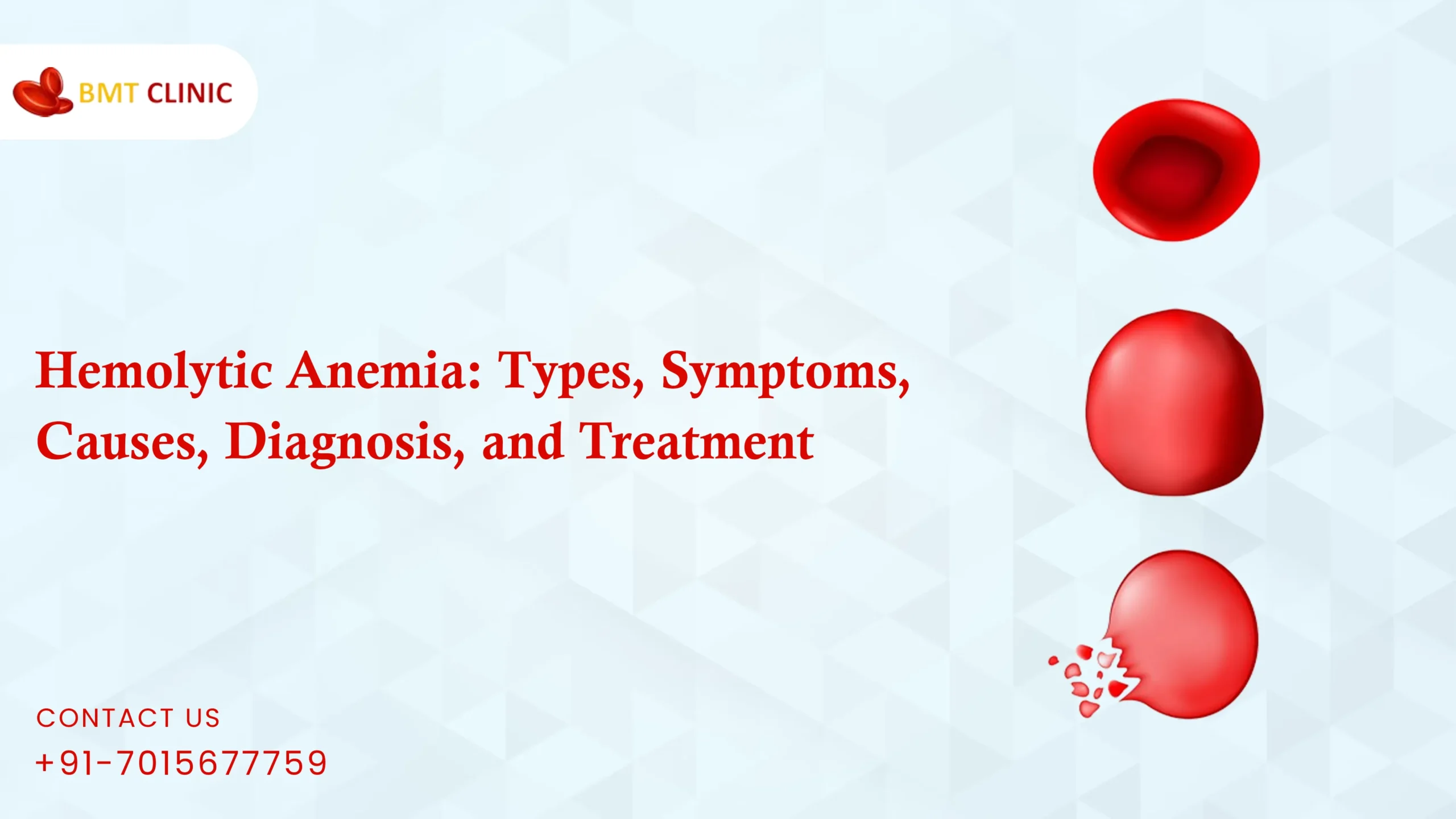 Hemolytic Anemia