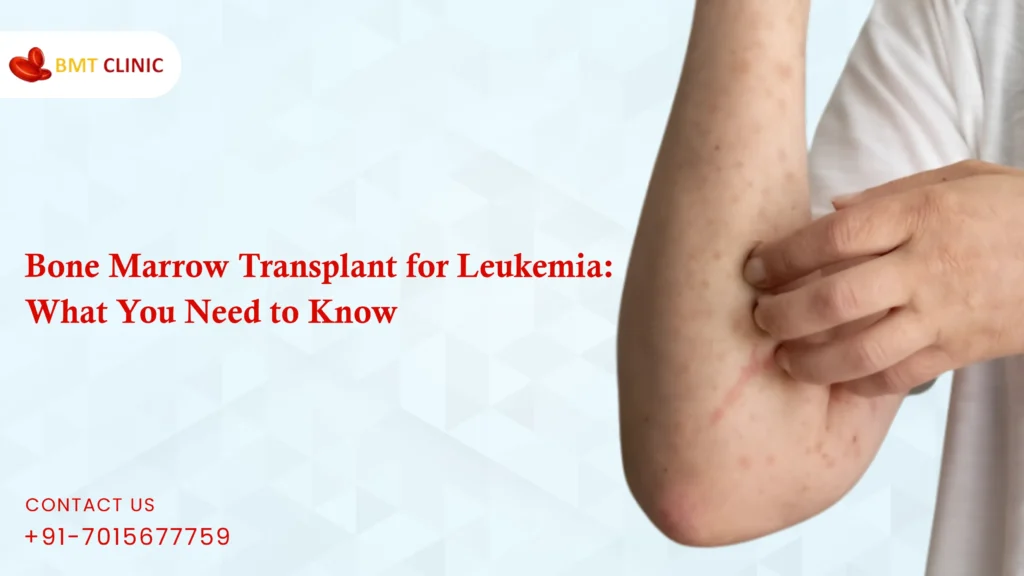 Bone Marrow Transplant for Leukemia