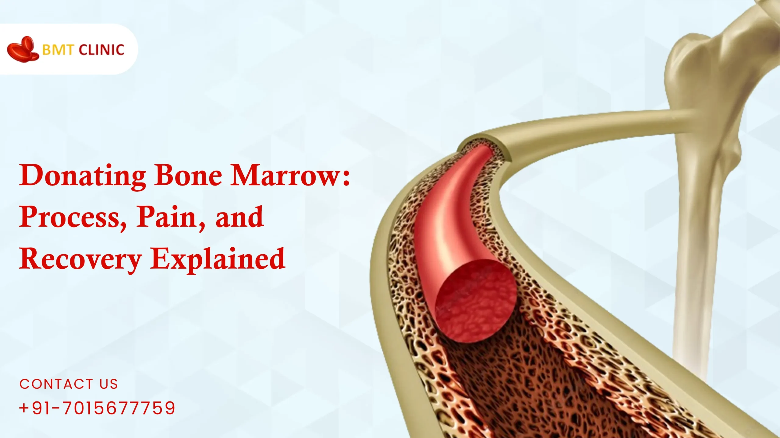 Donating Bone Marrow