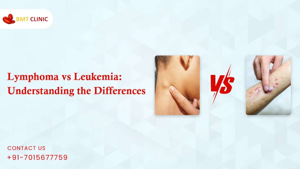 Lymphoma vs Leukemia