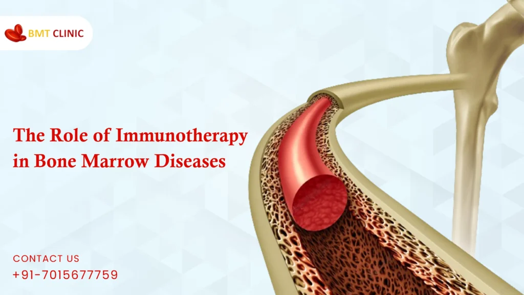 Learn how immunotherapy is transforming the treatment of bone marrow diseases by boosting the immune system to fight abnormal cells and improve patient outcomes.