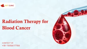 Radiation therapy for Blood Cancer