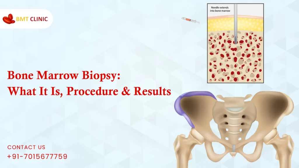 Bone Marrow Biopsy
