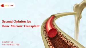 Second Opinion for Bone Marrow Transplant